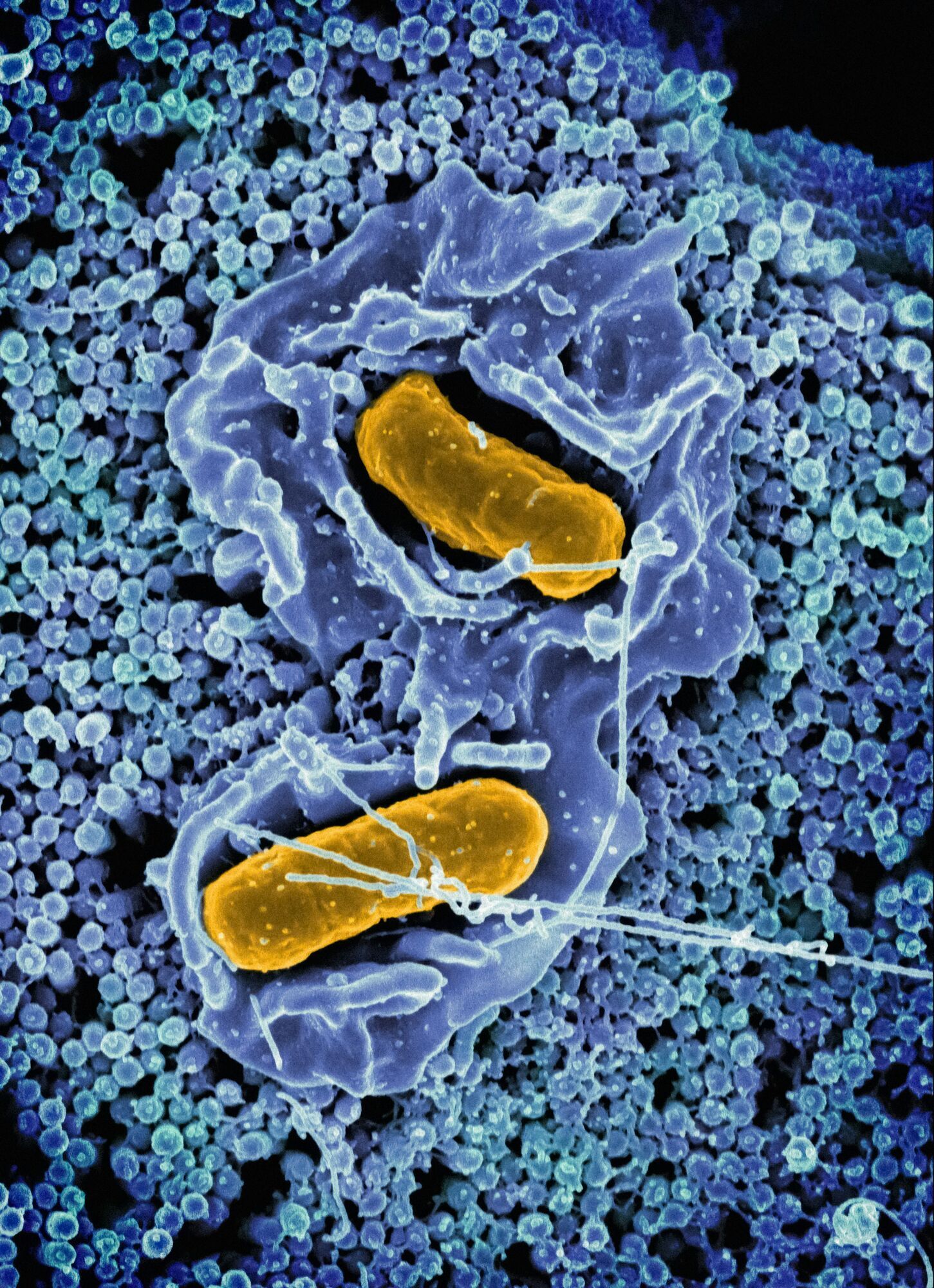 Microscopic view of Salmonella bacteria