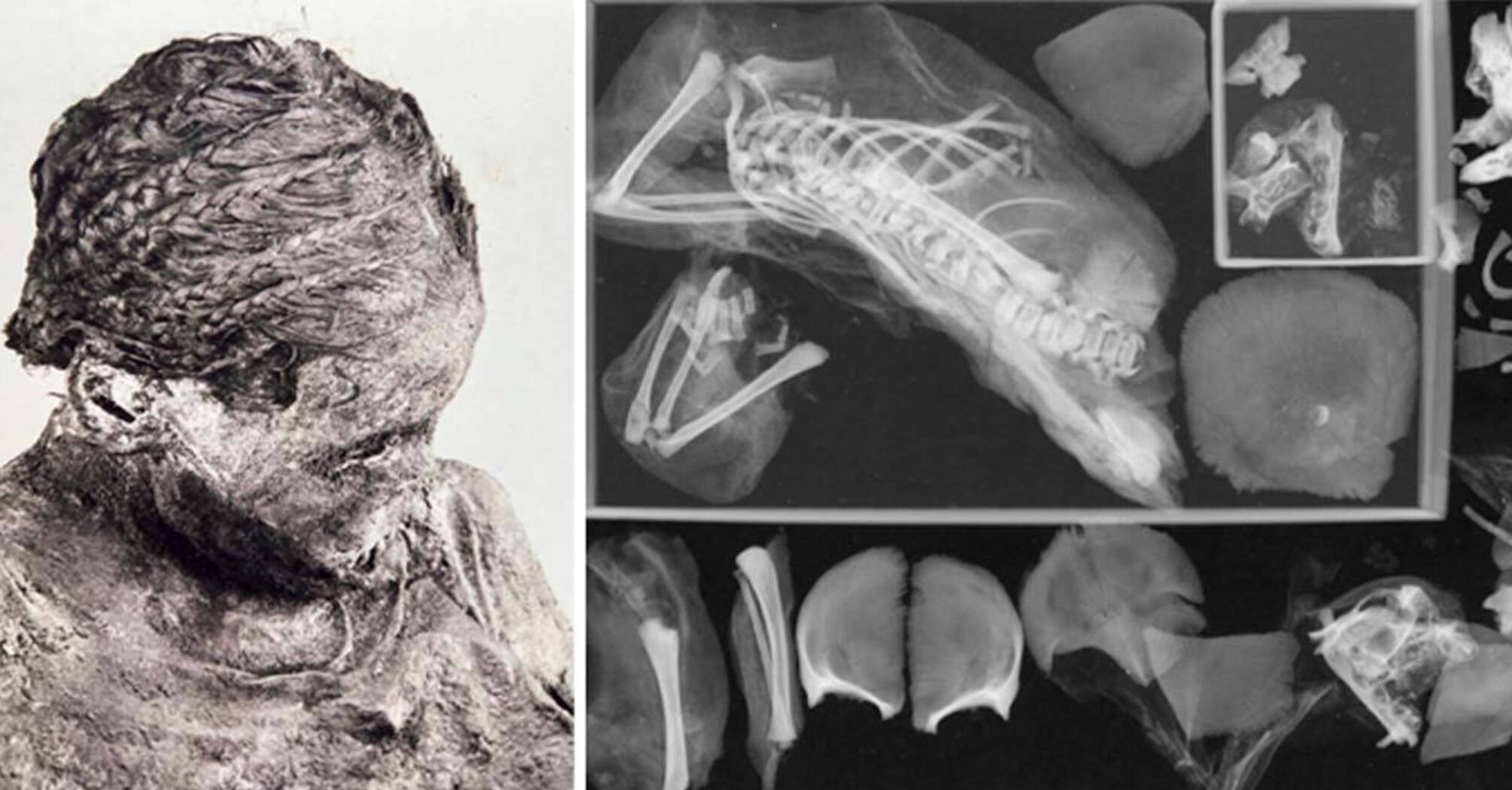 Scientists examine the mummy of a teenage mother pregnant with twins