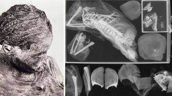 Scientists examine the mummy of a teenage mother pregnant with twins
