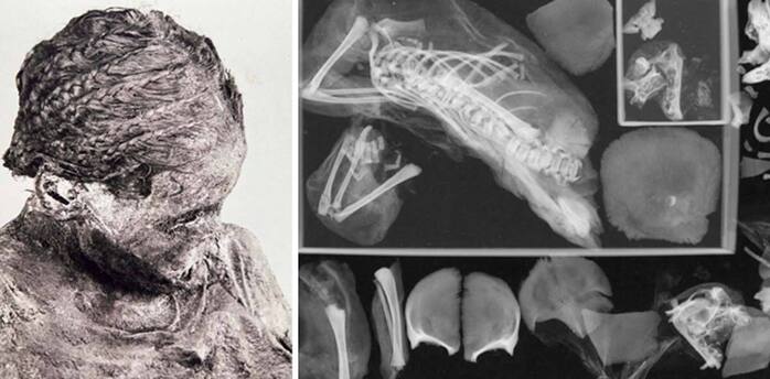 Scientists examine the mummy of a teenage mother pregnant with twins
