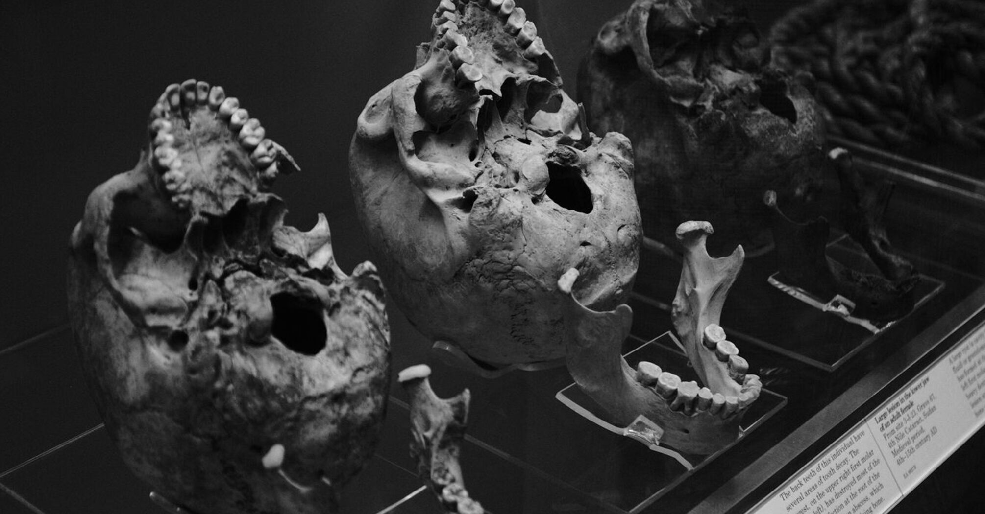 Ancient preserved skulls on display at the British Museum