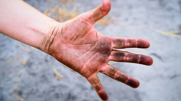 Dirty hand with visible grime